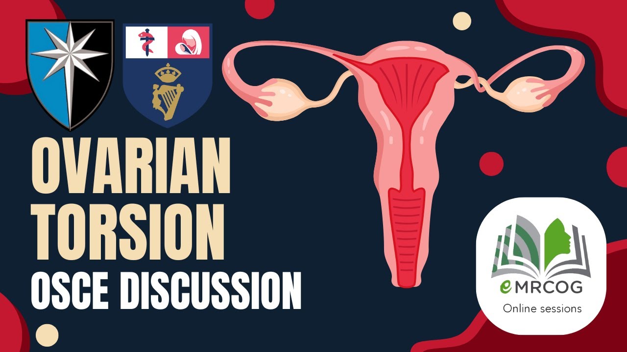 Ovarian torsion OSCE case & TOG Review MRCPI, MRCOG