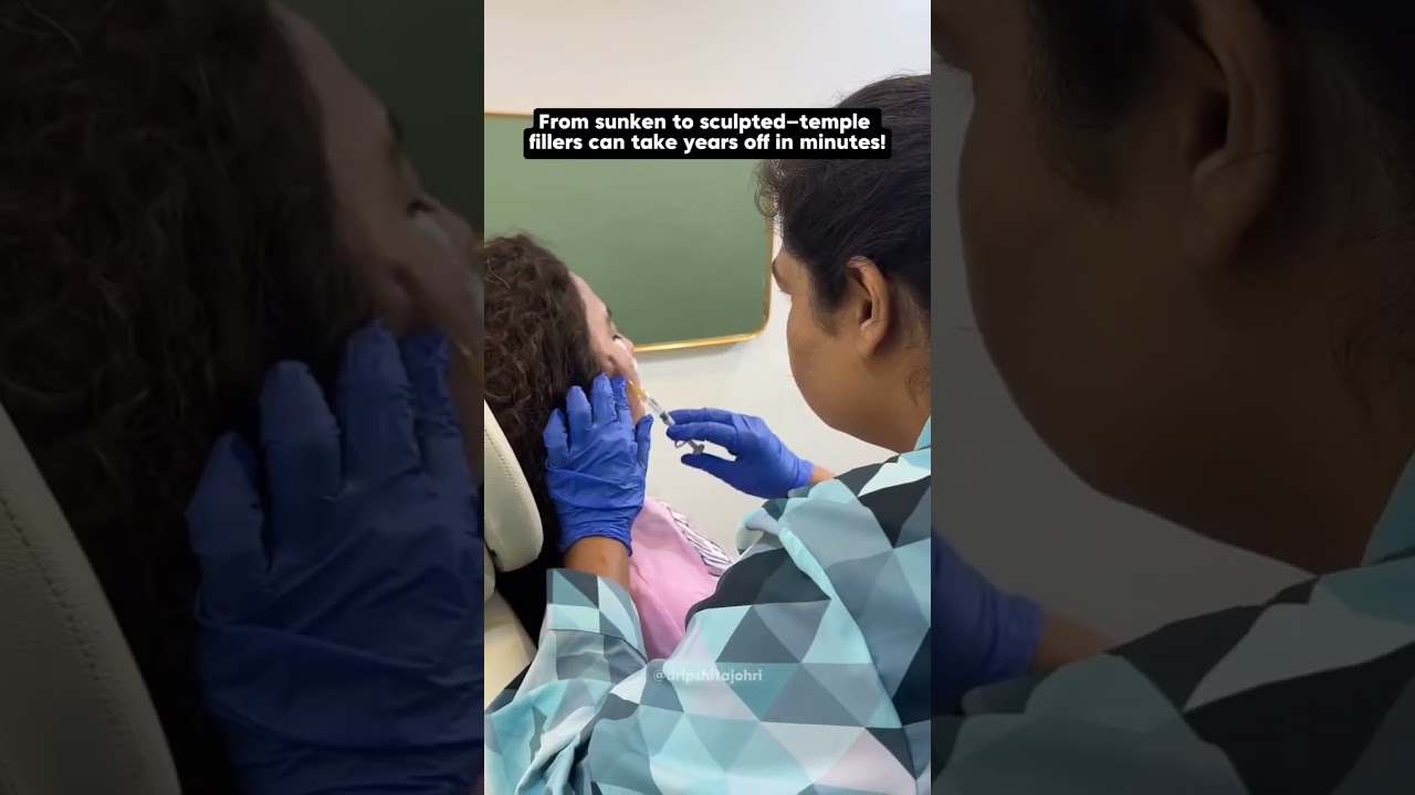 Fix Hollow Temples Instantly 💉 | The Secret to a Youthful Face