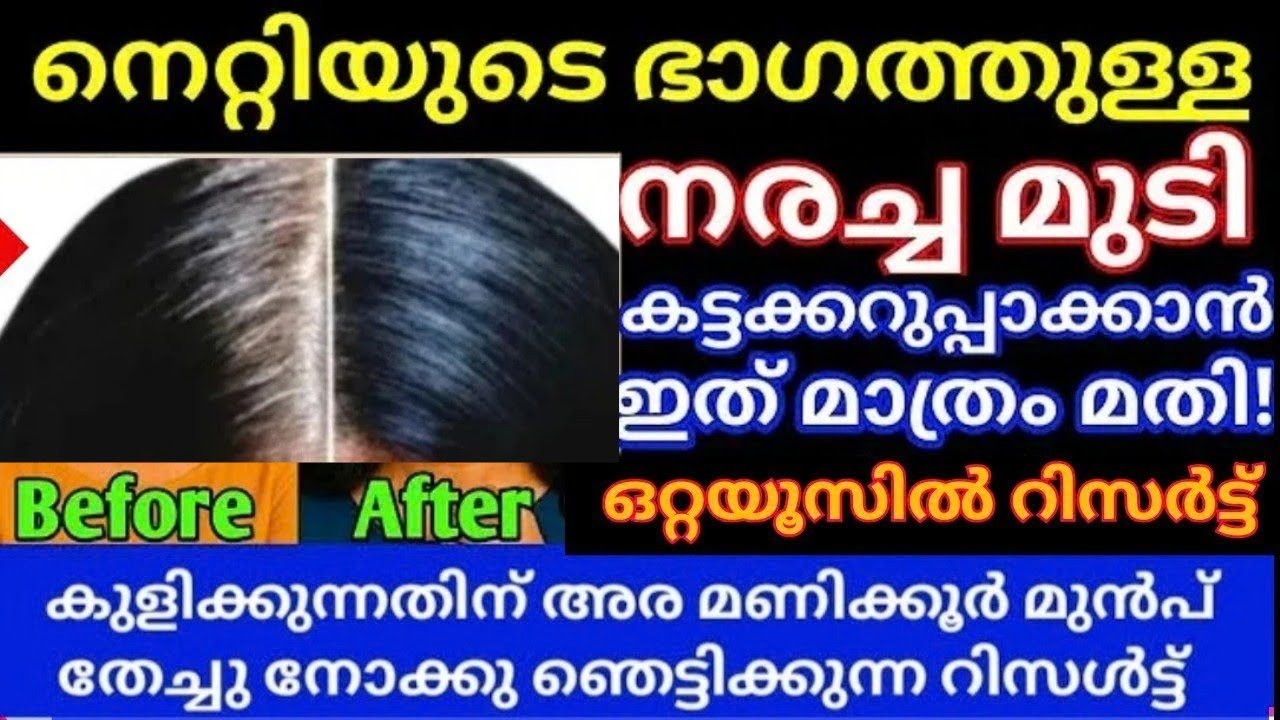 നെറ്റിയുടെ ഭാഗത്തും ചെവിയുടെ ഭാഗത്തുമുള്ള നരച്ചമുടി ഒറ്റ യൂസിൽ കറുക്കാൻ ഇത് മതി #trending #hairdye 