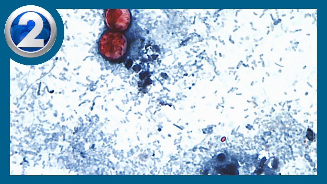 Officials investigating Hawaii's first cyclosporiasis case with no travel