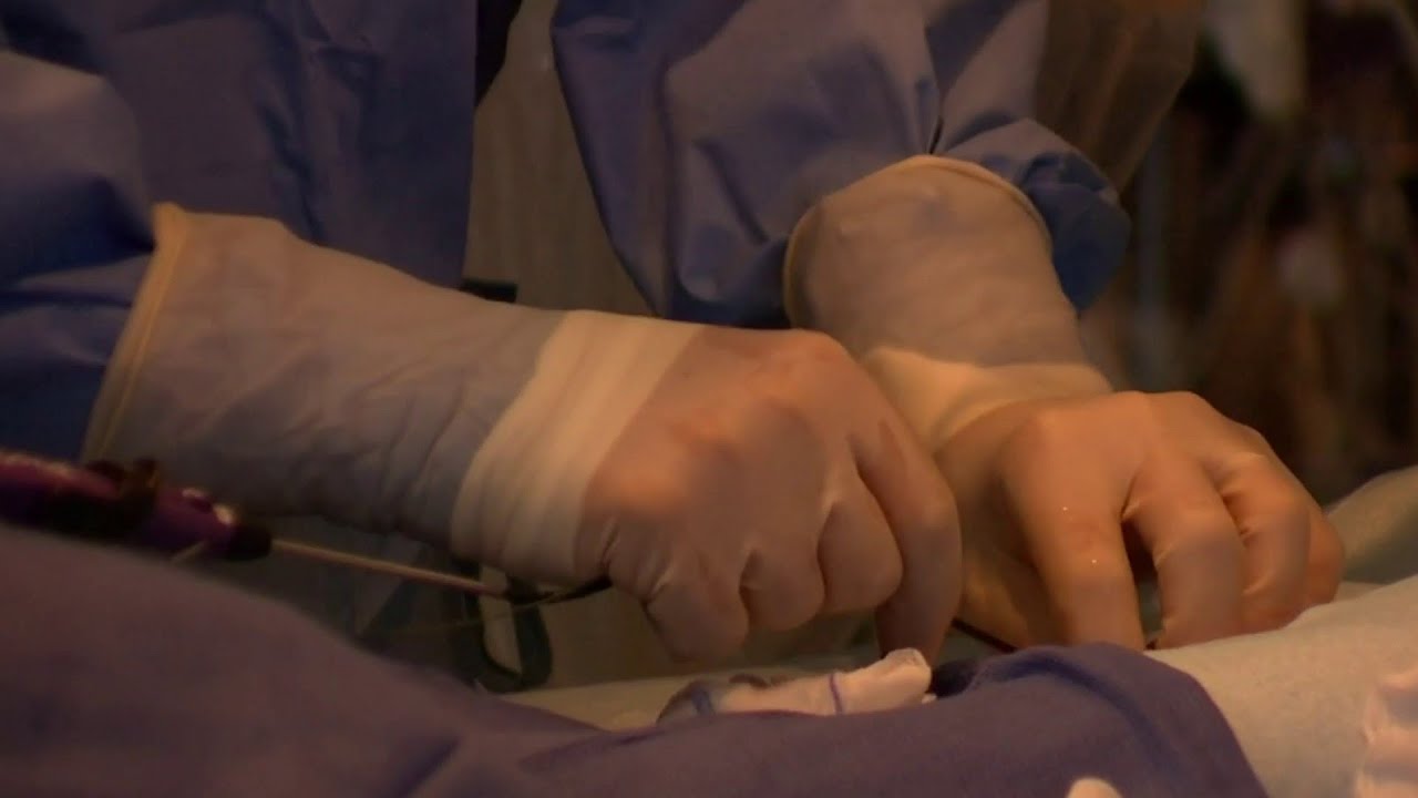 How pulse field ablation could have you walking hours after AFib surgery