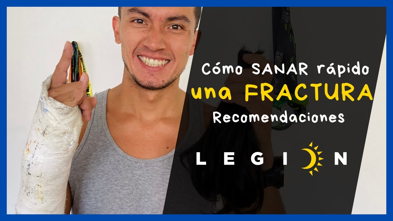 Cómo ACELERAR la recuperación de una FRACTURA | Mi fractura en muñeca izquierda | Legión OCR