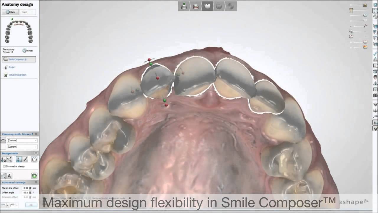 3Shape TRIOS Temporary Crowns