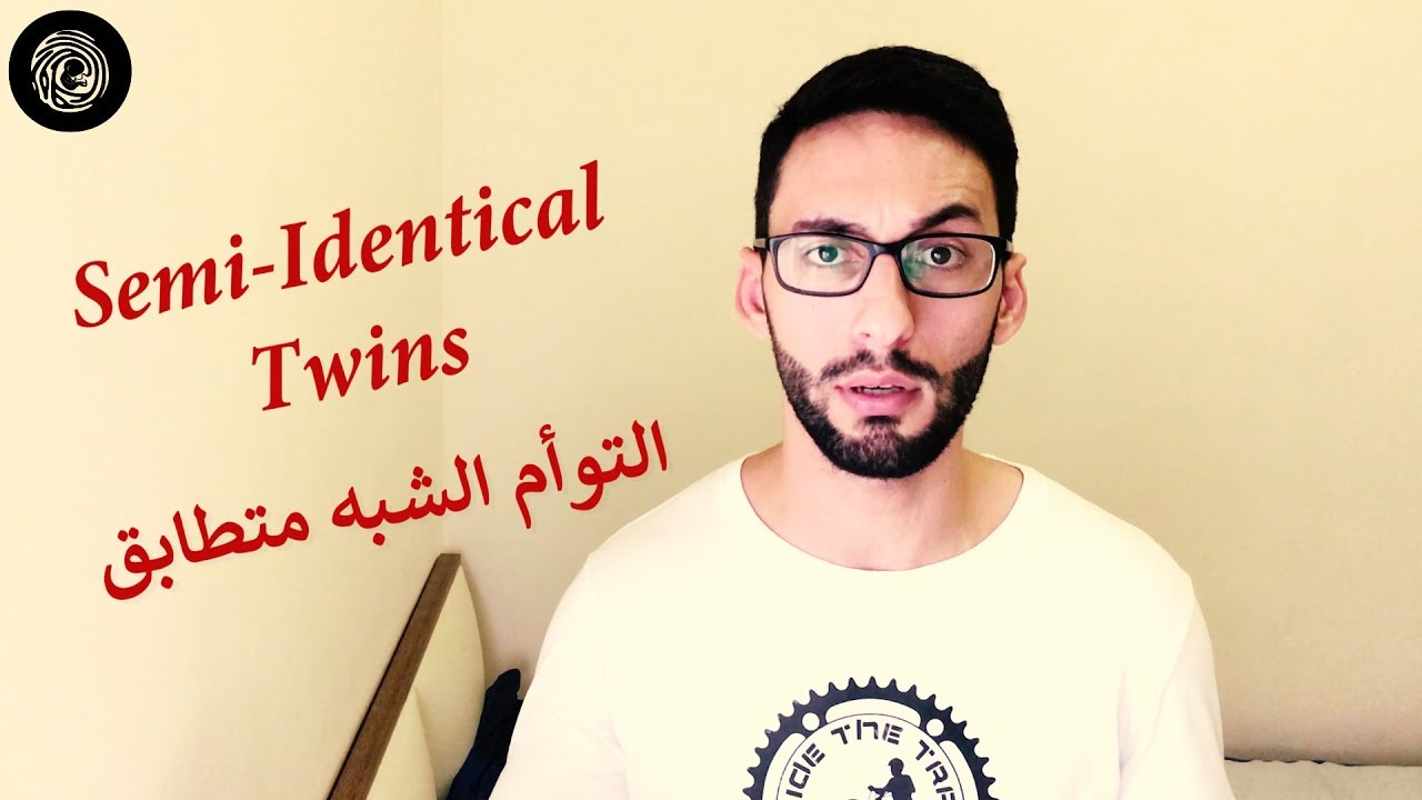 التوأم الشبه متطابق