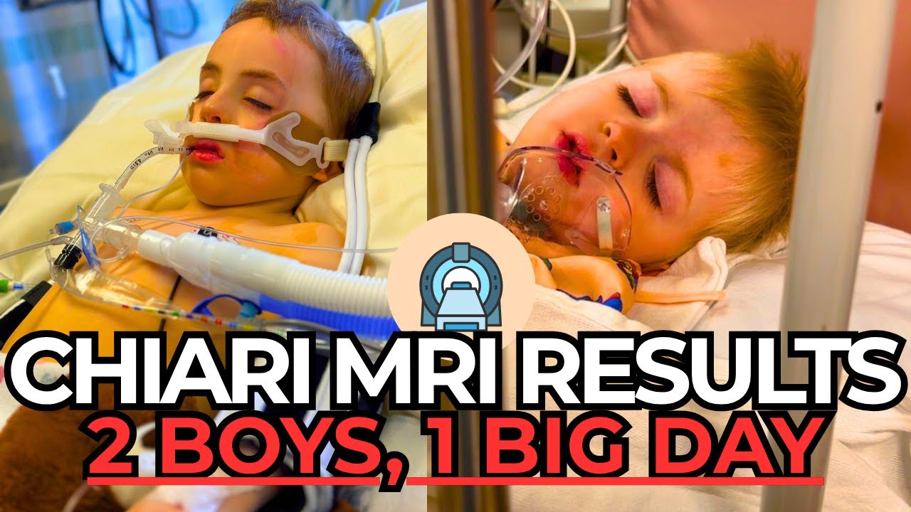 Chiari Malformation MRI Results | 2 Boys, 1 Big Day!