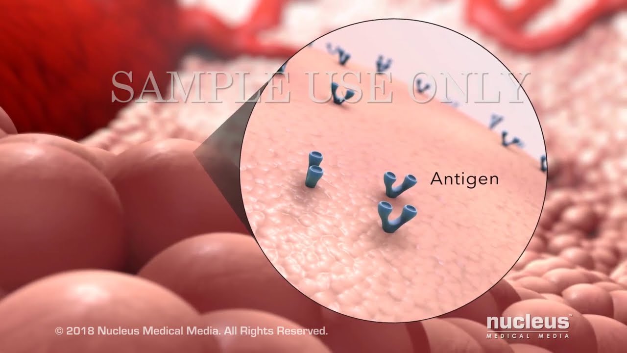 Immunoterapia raka