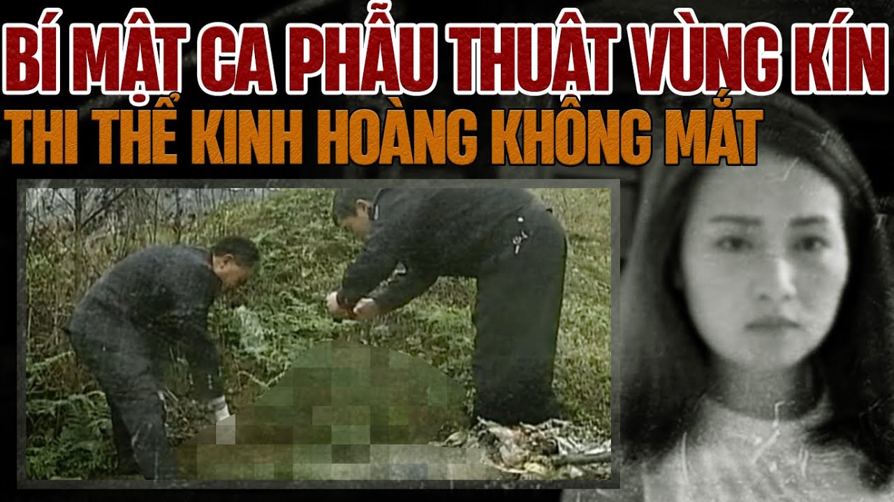 Kỳ Án Trung Quốc : Bí Mật Ca Phẫu Thuật Vùng Kín
