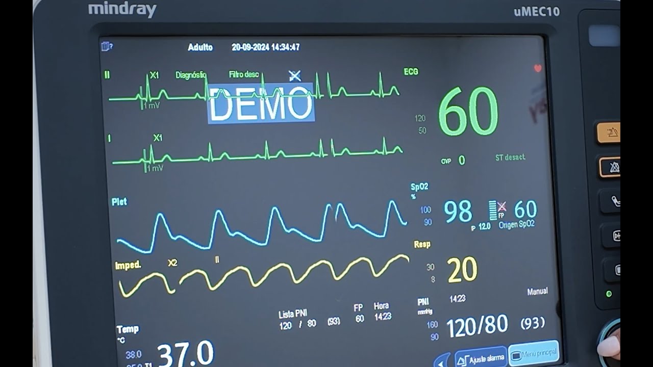 Capacitación: Monitor de Signos Vitales uMEC10 Mindray