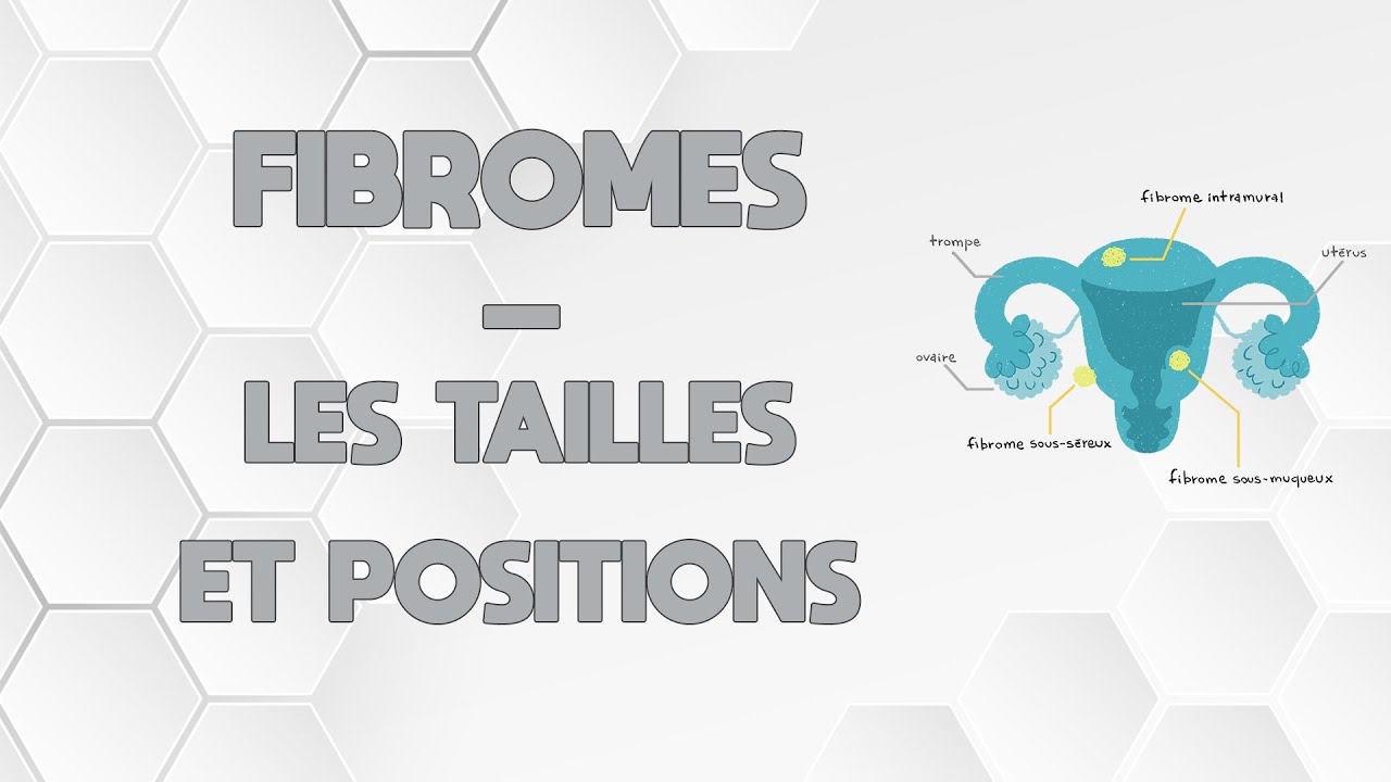 LES FIBROMES - TAILLES ET POSITIONS