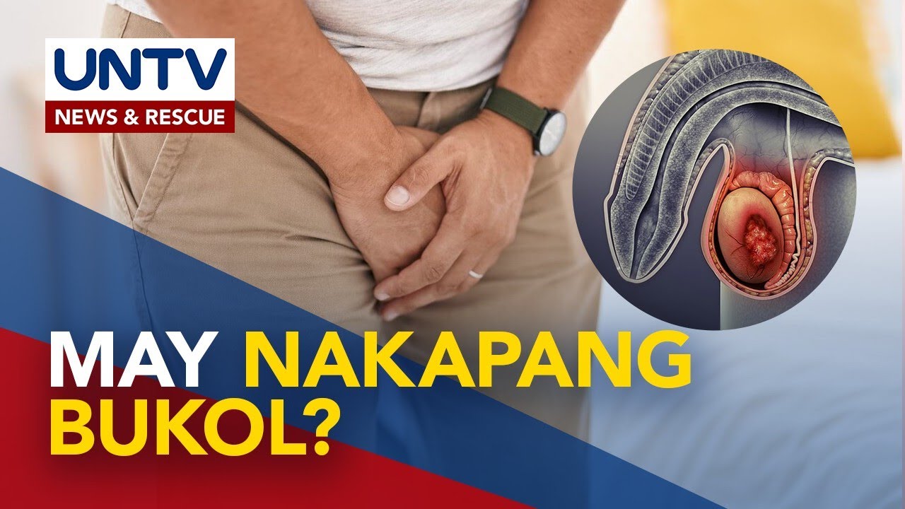 Bukol sa bayag &ndash; Paano malalaman kung kanser o hindi?