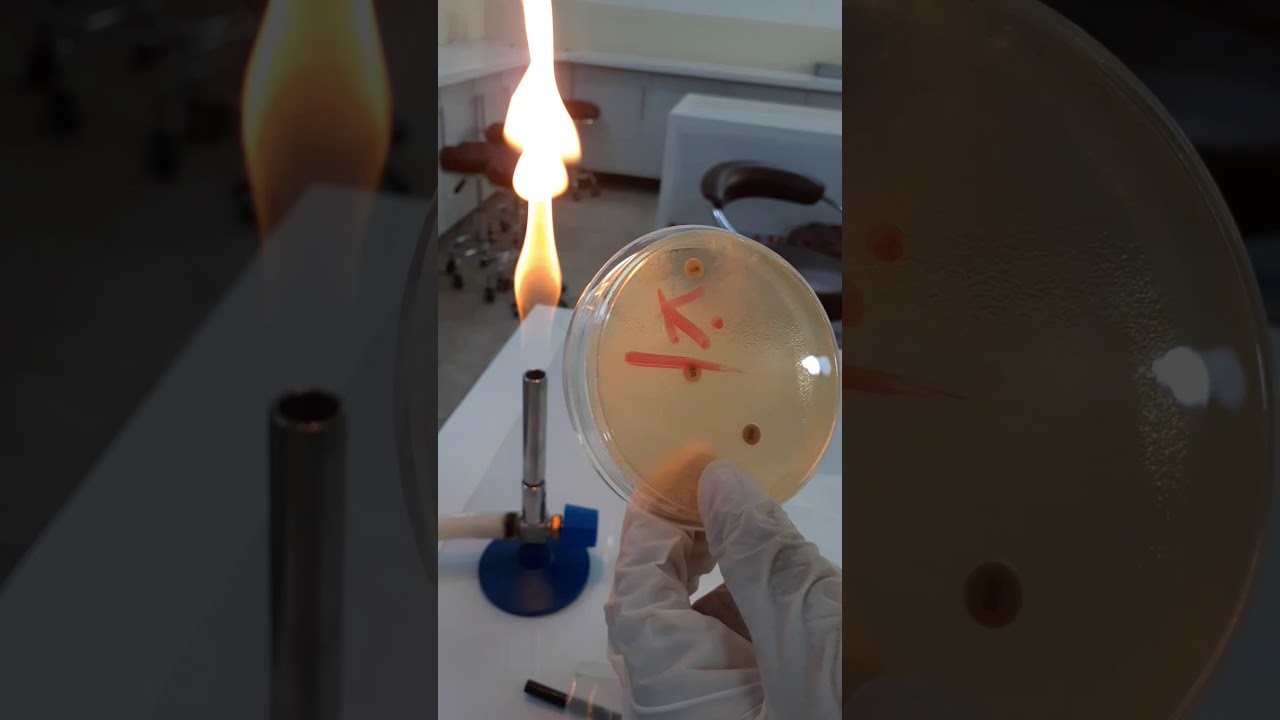 Antibiotic Sensitivity Test اختبار حساسية المضادات الحيويه شرح ست دموع