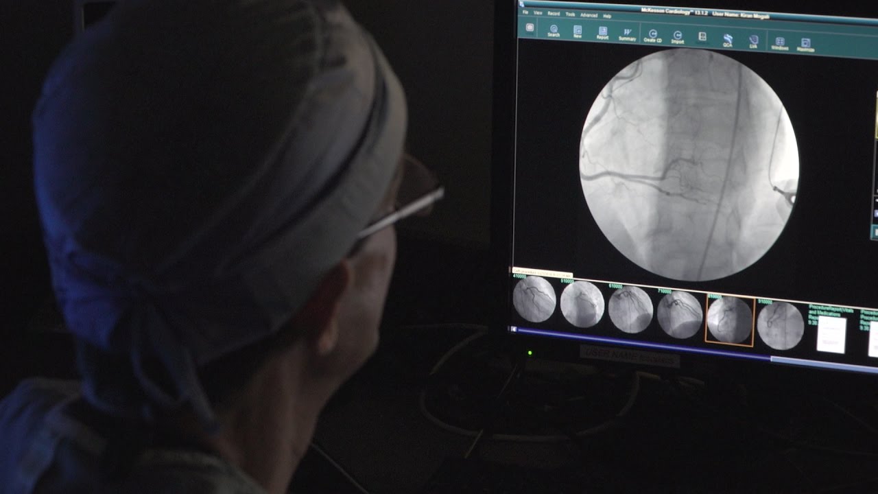 Simple genetic test shows promise for better outcomes in heart stent patients