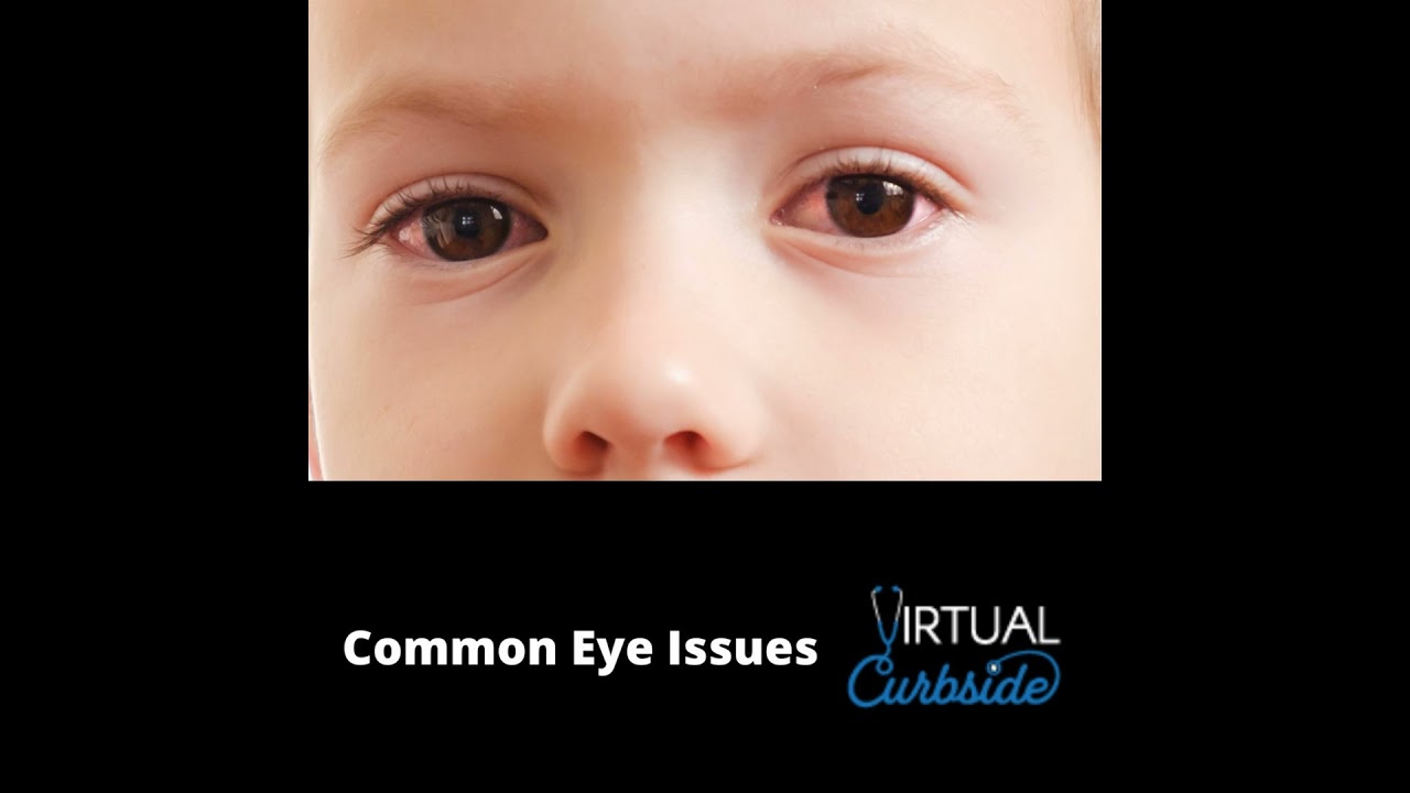 Episode 368: #85-4 Common Eye Issues: Q & A