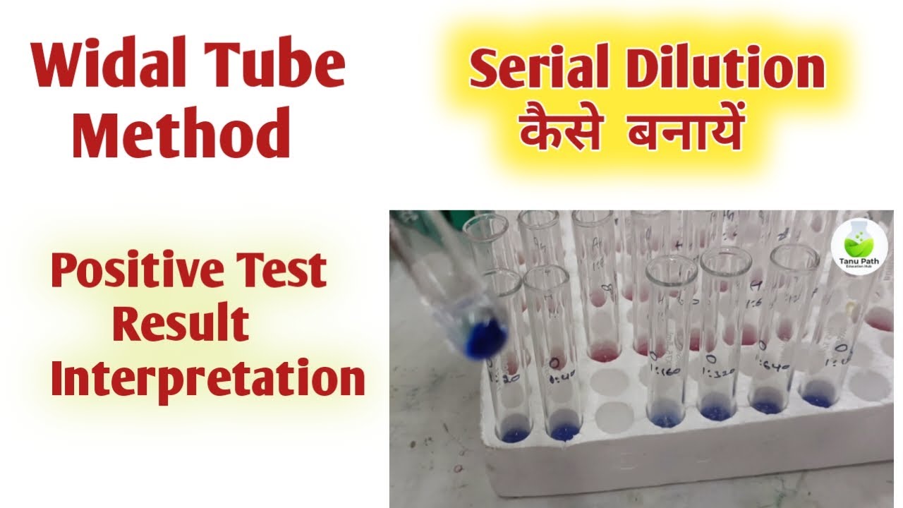 widal tube method procedure I widal tube method test