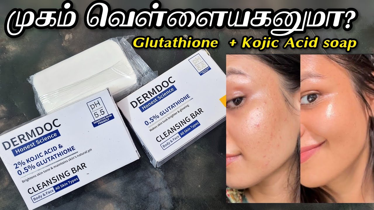 Dermdoc Kojic Acid vs Glutathione Soap Review in Tamil | Skin Whitening? Real Truth! #skinwhitening 