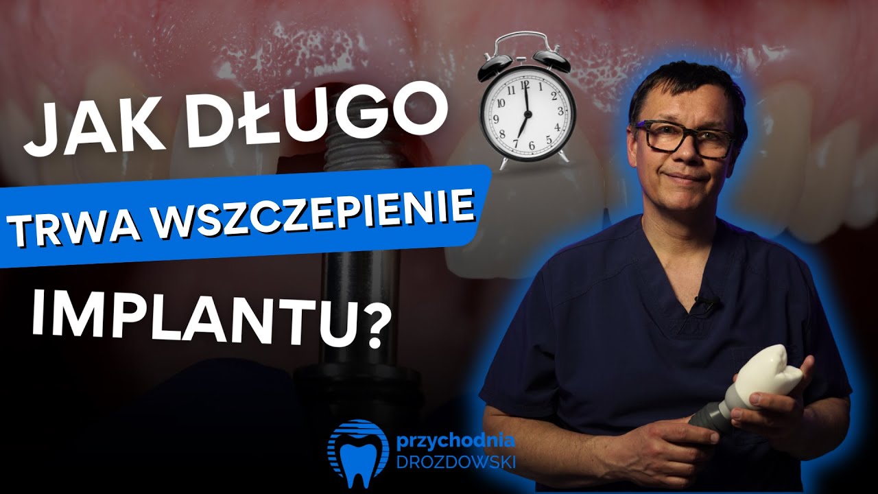 ILE trwa wszczepienie IMPLANTU? | Przychodnia Drozdowski