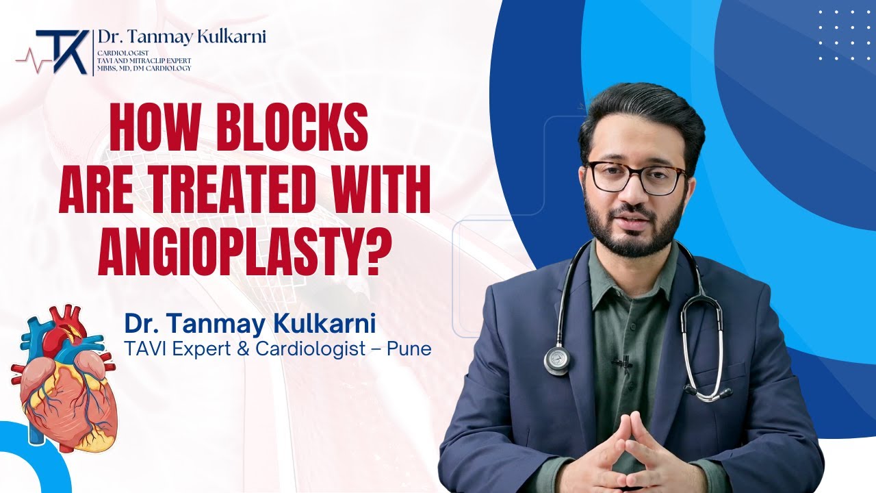 Heart Blockage Explained | Angioplasty, Stents & Latest Advancements | Dr. Tanmay Kulkarni