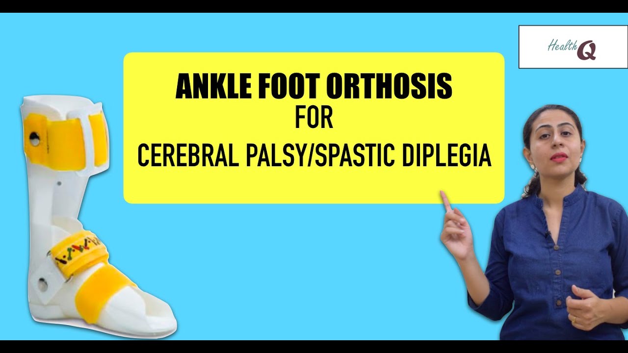 Things you should know about ANKLE FOOT ORTHOSIS