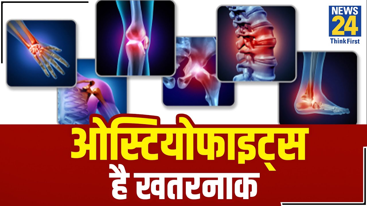 Sanjeevani: डॉ. प्रताप चौहान से जानिए क्यों और कैसे होता है हड्डियों से जुड़ा रोग 'ओस्टियोफाइट्स' ?