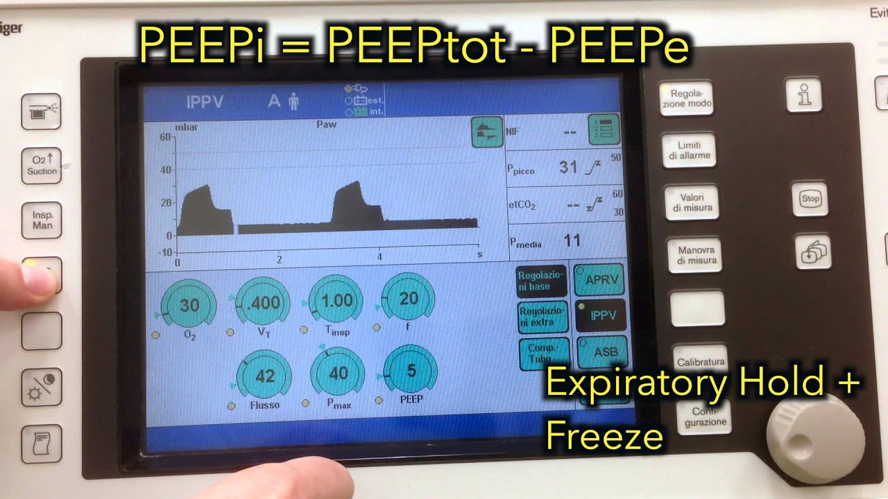 Intrinsic PEEP (or auto-PEEP) on Draeger Evita 4 ventilator
