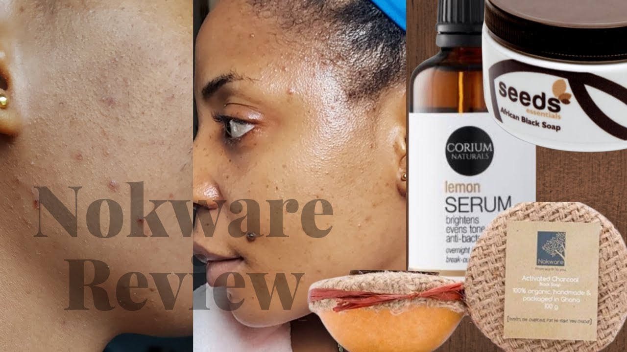 Breaking out suddenly? Nokware Skincare review | Corium Natural Lemon Serum Review | Seeds blacksoap
