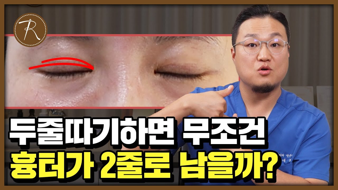 두줄따기 흉터, 두 줄로 안 남을수도?