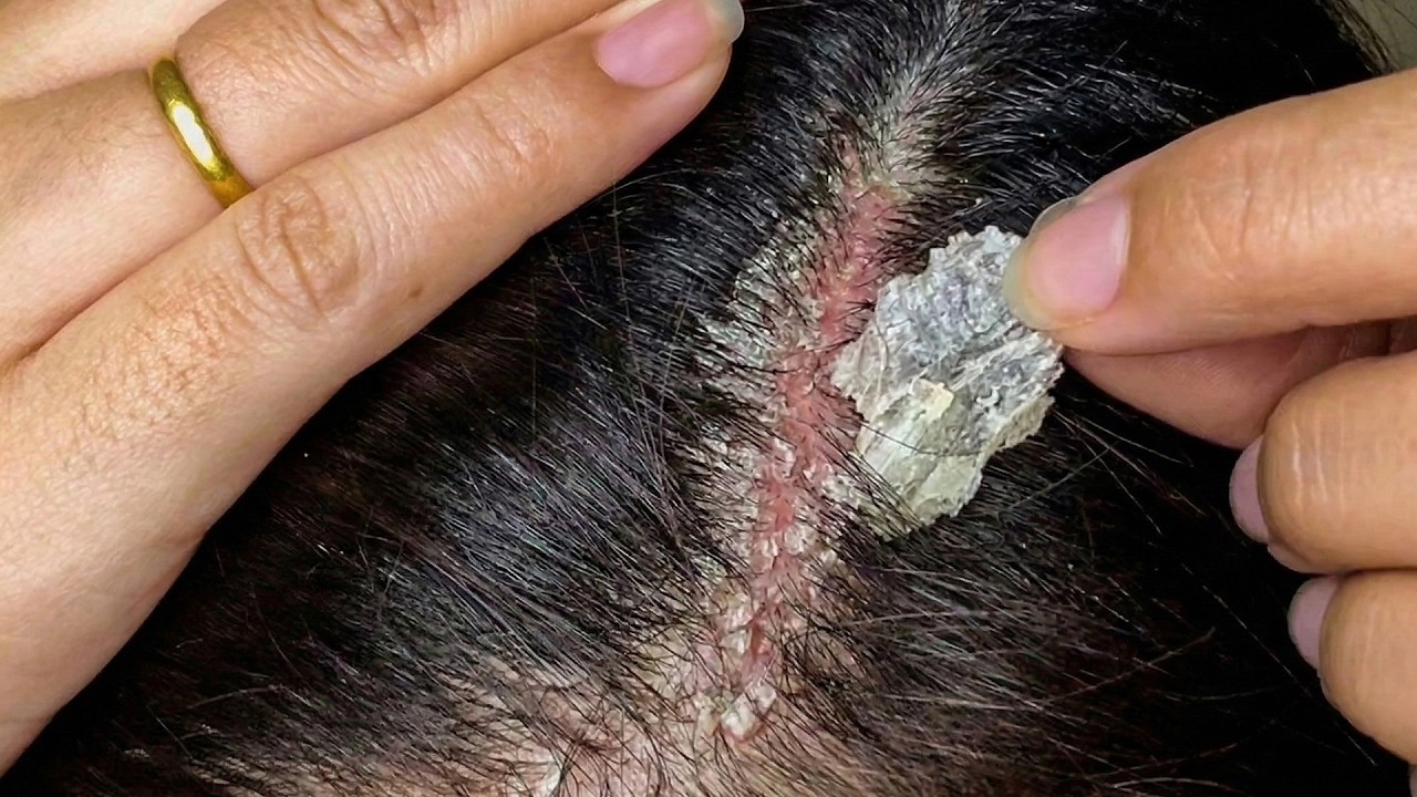 Hair Brushing & Scalp Scratching ASMR#S0056