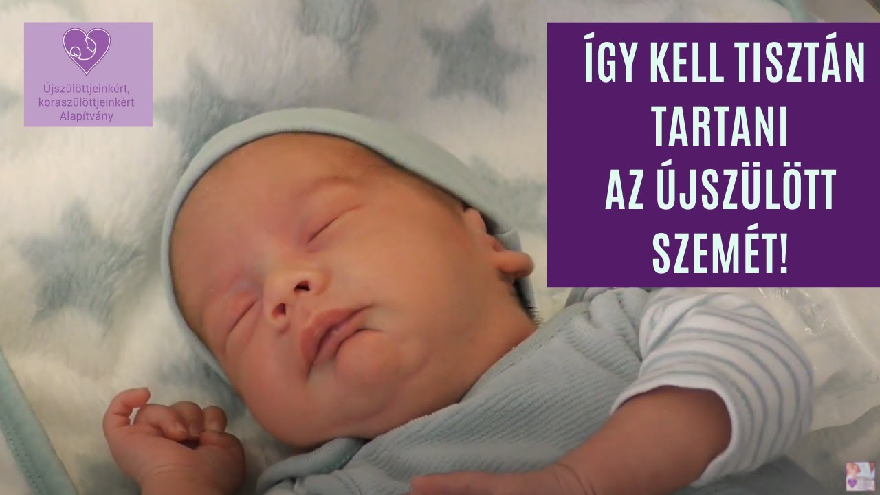 Így kell tisztán tartani az újszülött szemét!