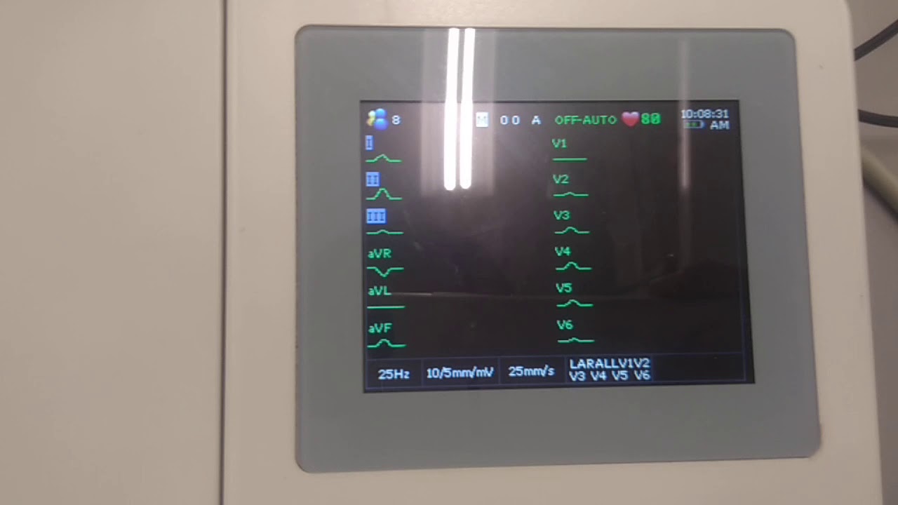 electrocardiografo EDAN SE3