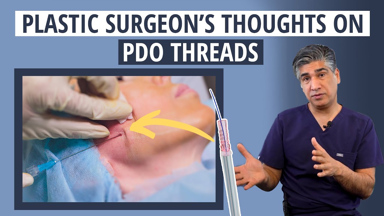 Watch this before you get PDO Threads | Facial Plastic Surgeon