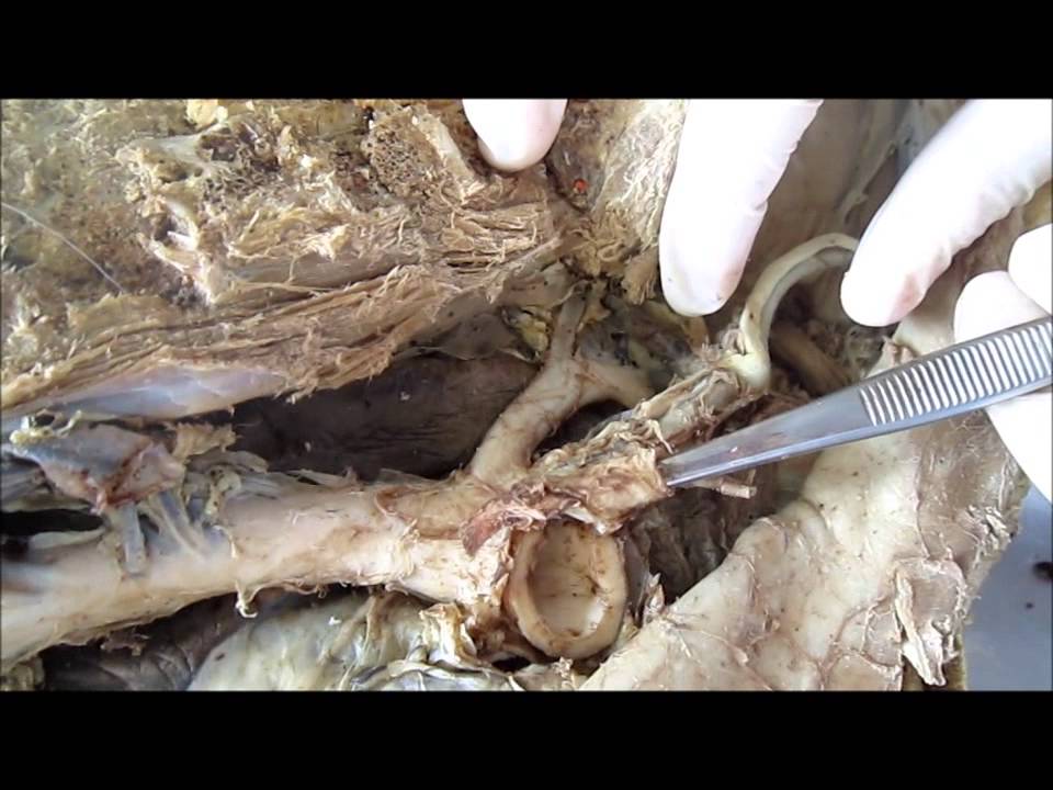 Descripci&oacute;n de aorta y sus ramificaciones
