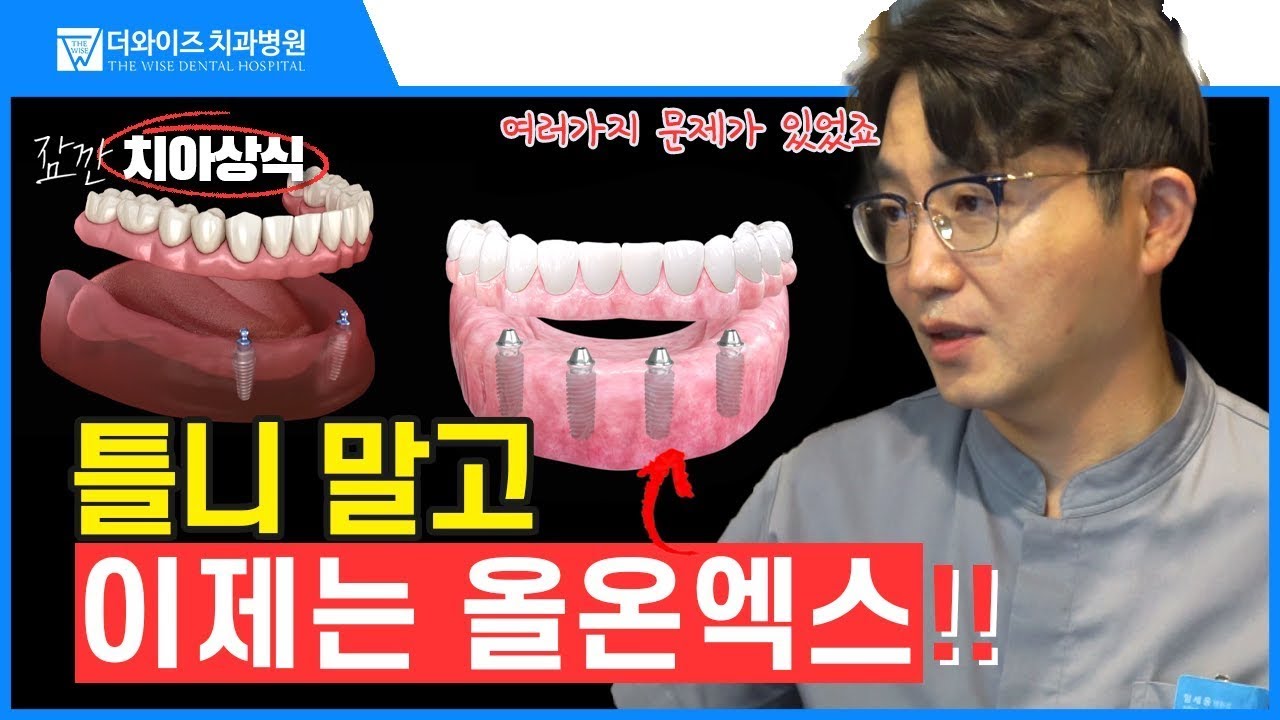 올온엑스의 모든 것을 알려드립니다 ft.틀니