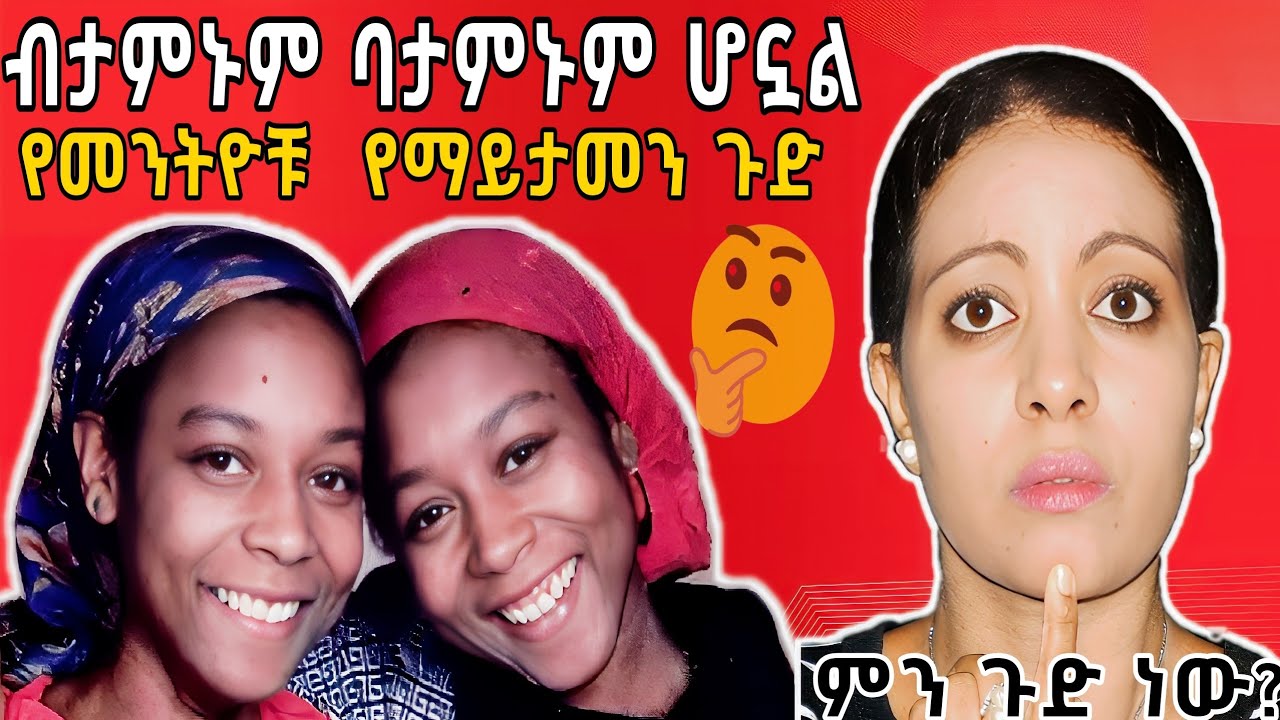 🛑እንዲህ አይነት መንትዮችም አሉ