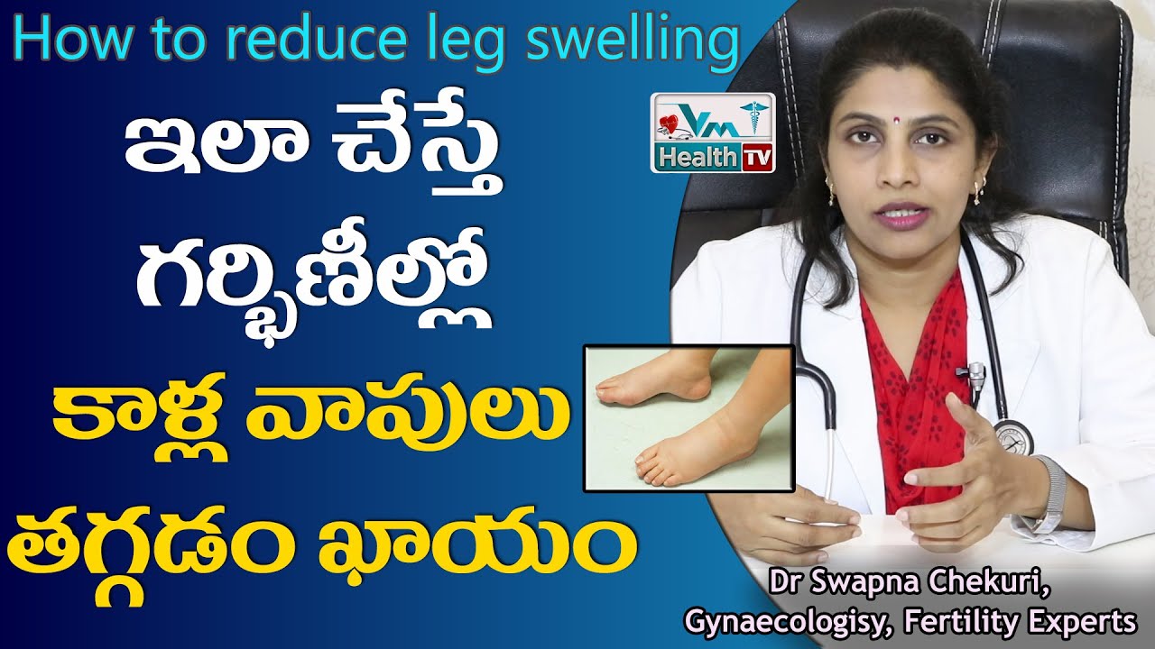 ఇలా చేస్తే ప్రెగ్నెన్సీ టైంలో కాళ్ల వాపు తగ్గించుకోవచ్చు | How To Reduse Swollen Feet In Pregnancy