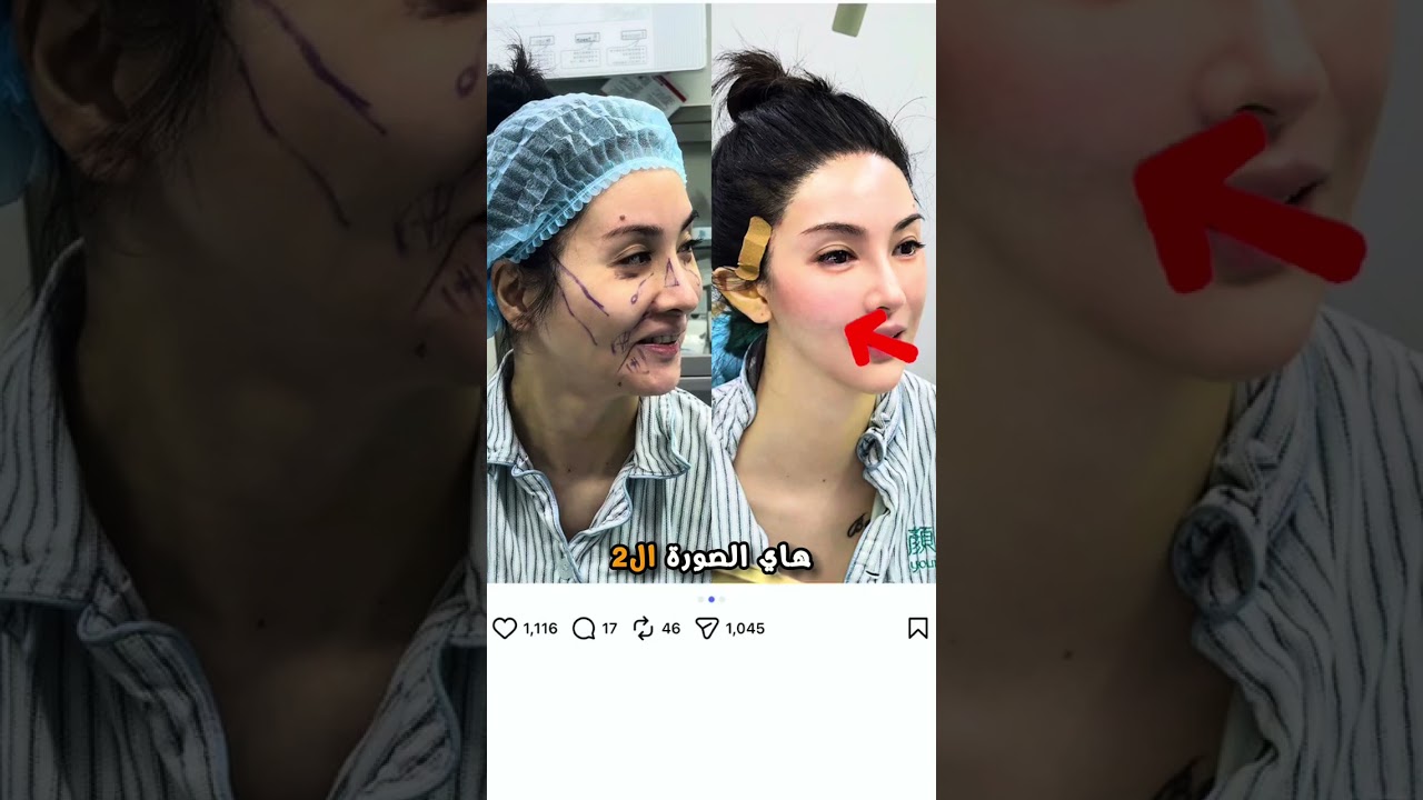 مخاطر الذكاء الصناعي في التجميل 