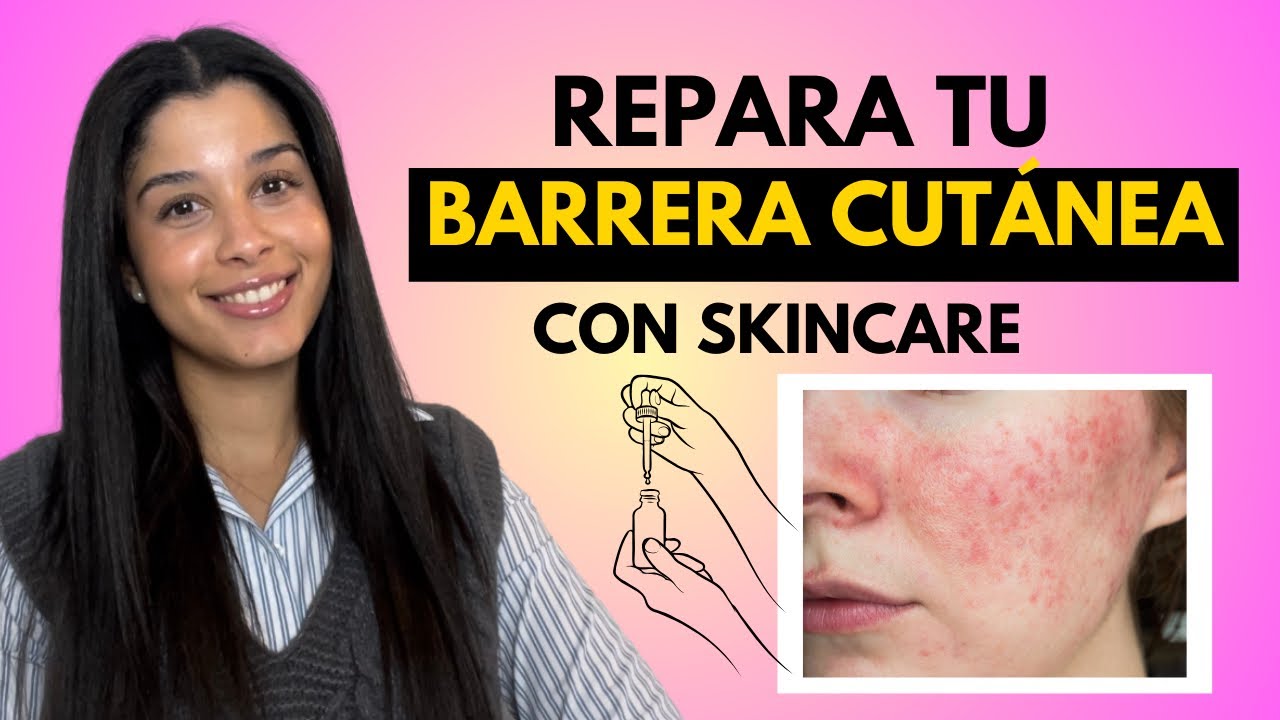 C&oacute;mo Reparar tu Piel en 4 Pasos: Piel Irritada y Da&ntilde;ada | Enfermera Dermoest&eacute;tica