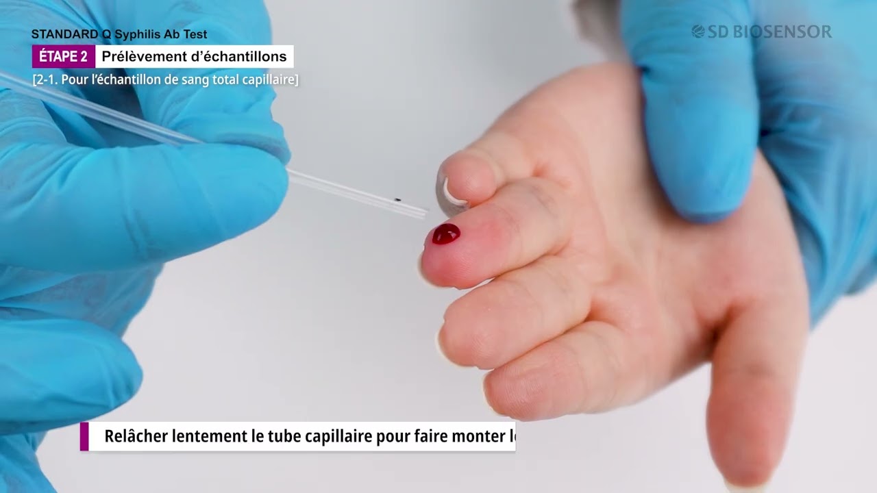 [FR] Guide for STANDARD Q Syphilis Ab Test