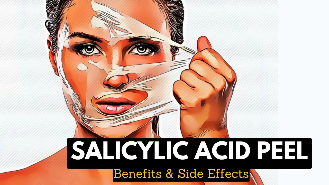 Flawless Complexion or Skin Sensitivity? Understanding the Effects of Salicylic Acid Peels