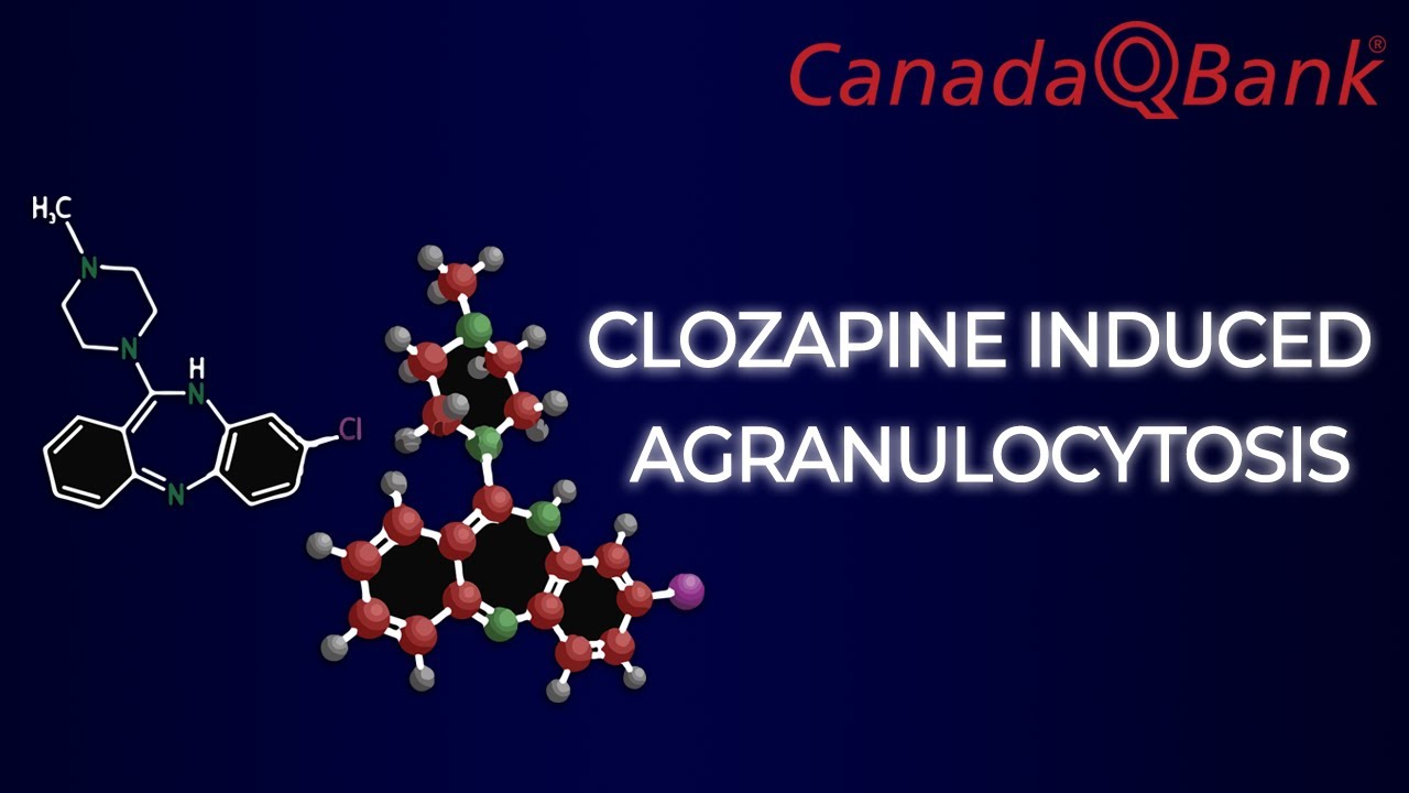 Агранулоцитоз, вызванный клозапином
