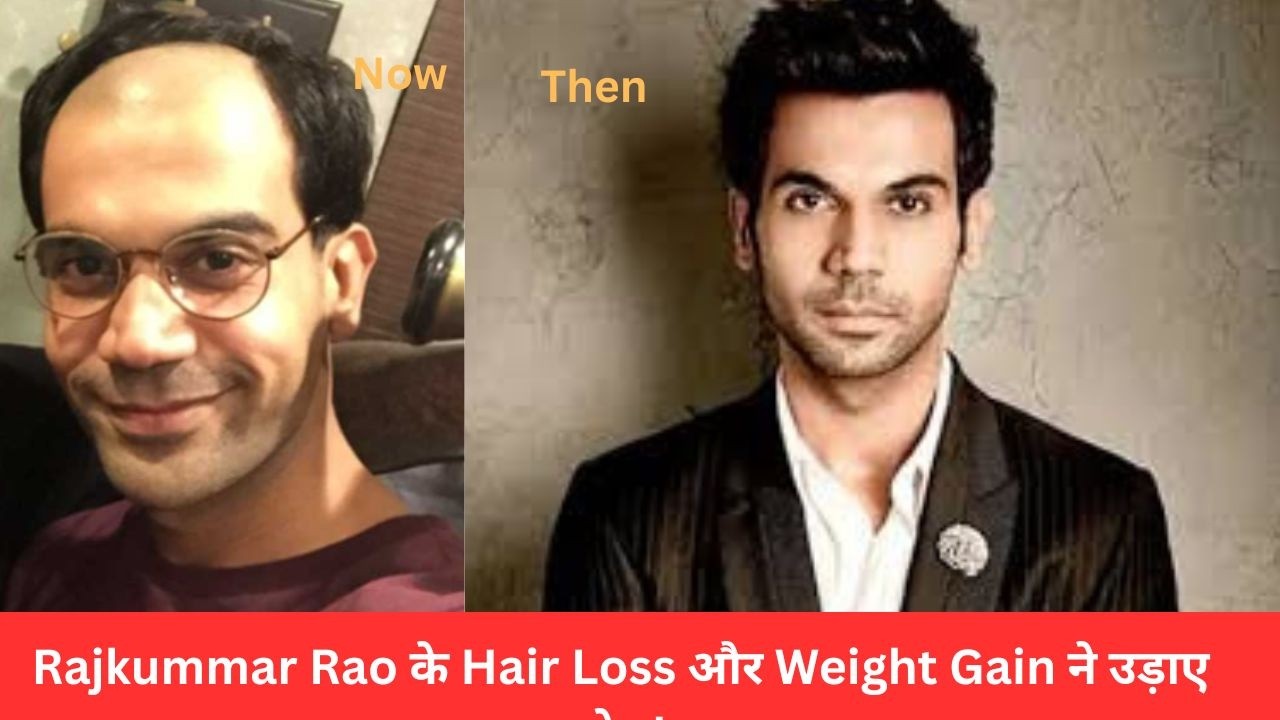 Rajkummar Rao का बदला Look– बीमारी है??