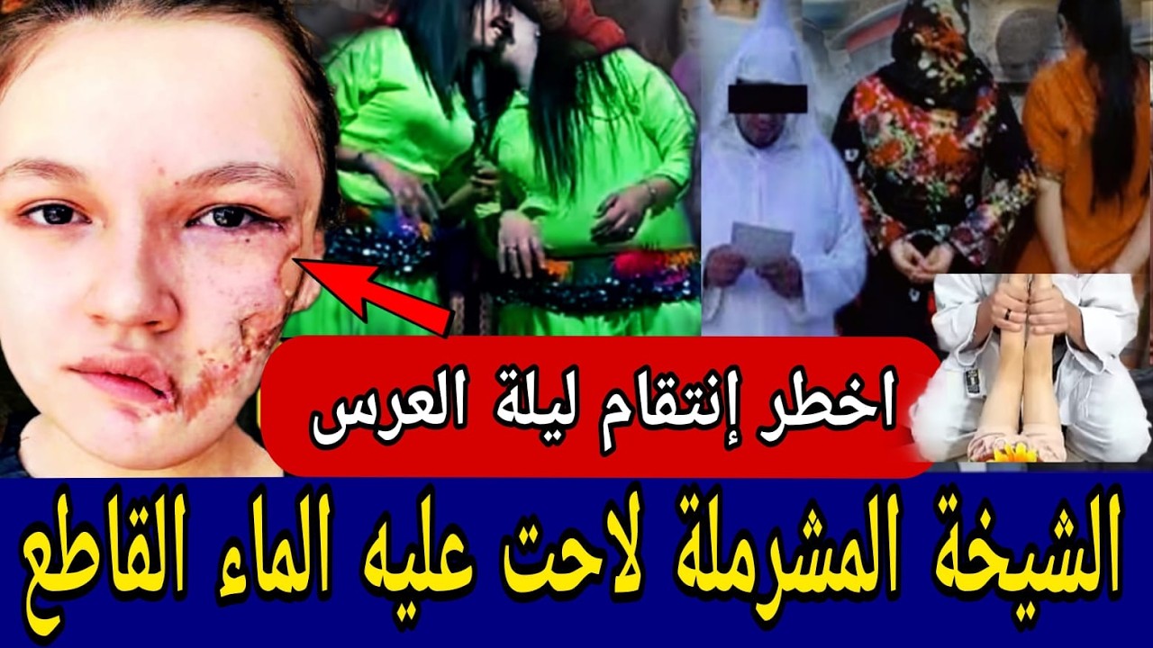 الشيخة المشرملة حسنات ليه وجهوا بالماء القاطع 🔞 ليلة عرسها فضحتها بالعلالي  ⛔️ كيد العشيقة