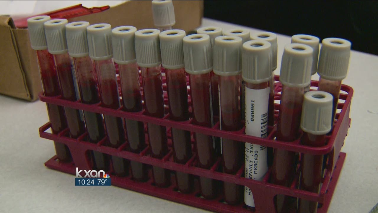New staff at APD forensics lab paying dividends