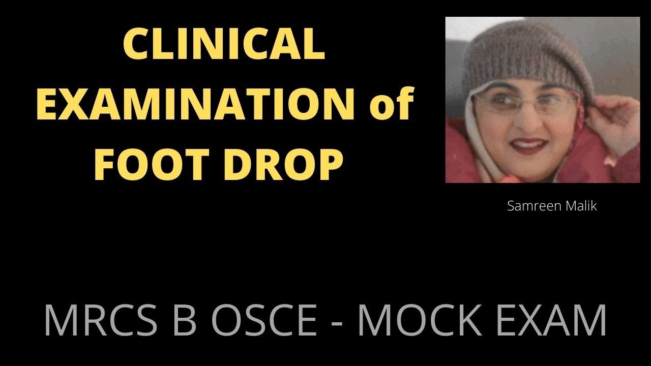 CLINICAL EXAMINATION of FOOT DROP