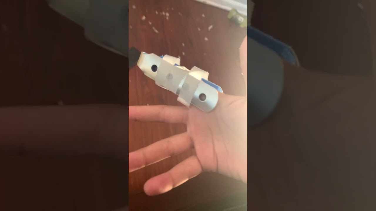 I fractured my finger playing gorilla tag