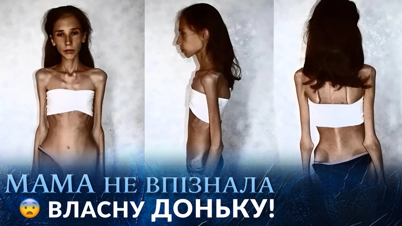 Бабуся морила ГОЛОДОМ онуку та ледь її не ВБИЛА! ЖАХ на 