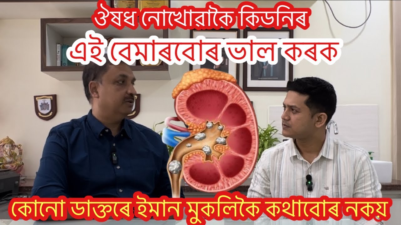 এইটো জানিলে আপোনাৰ Kidneyত কেতিয়াও পাথৰ নহয় l 8811090500