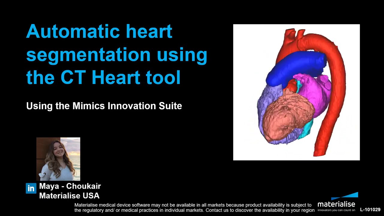 Автоматическая сегментация сердца с помощью инструмента CT Heart | Materialise Mimics 22