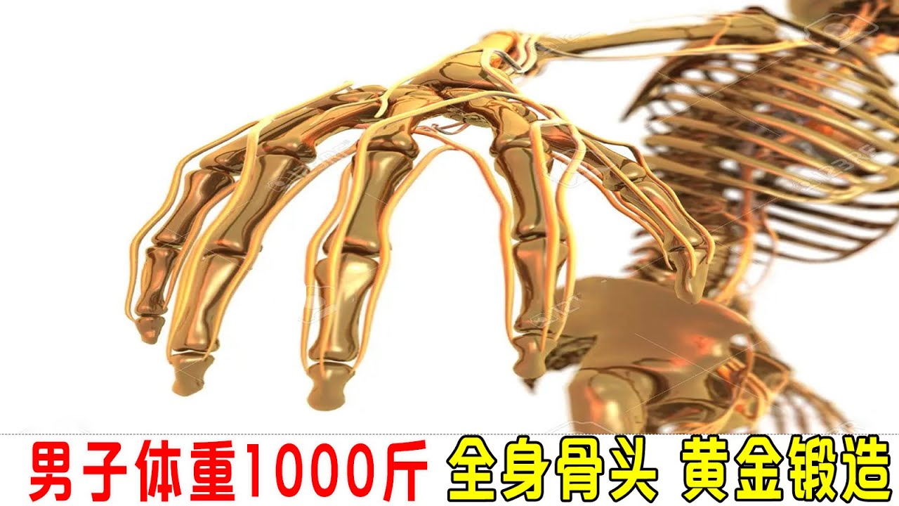 男子体重1000斤，全身骨头和关节由黄金锻造，花費3000萬美金！