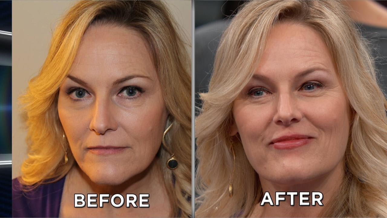 2-Minute Lip Plump: Results