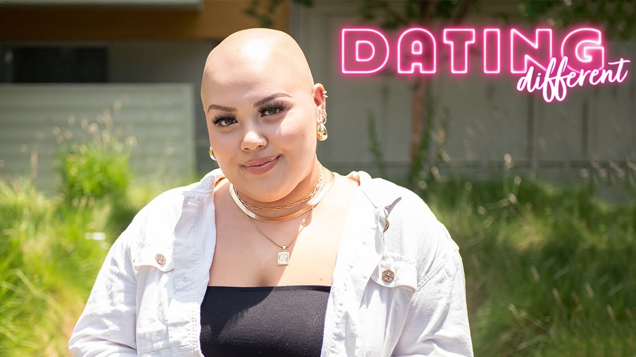 I Think My Bald Head Is Sexy - But Will My Blind Date? | DATING DIFFERENT